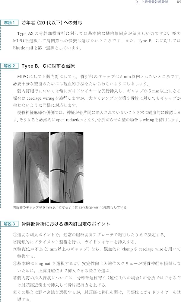 Amazon.co.jp: 「考える」外傷整形外科! : 土田 芳彦: 本
